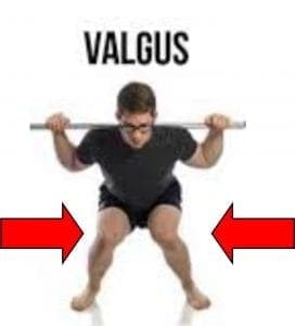 valgus.jpeg