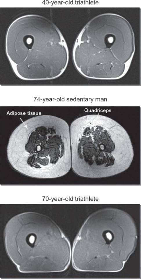 Chronic Exercise Preserves Lean Muscle Mass