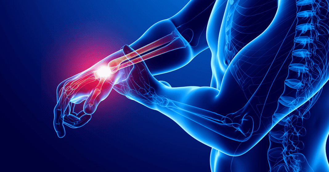 Through Pain Should You Train Through Pain? A Physio Explains What Hybrid Athletes ...