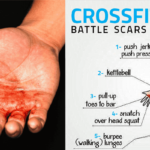 Crossfit-injuries