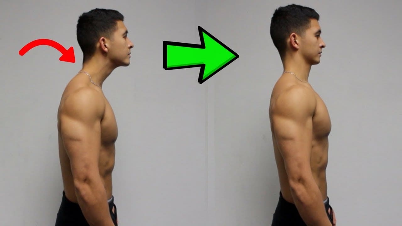 How to Fix Forward Head Posture (Text Neck) with One Daily Corrective  Routine