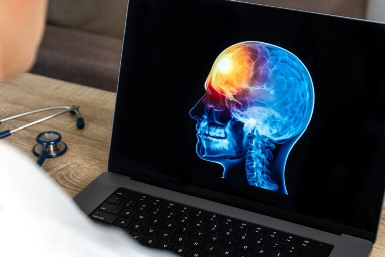 How Compensation Works in Traumatic Brain Injury Cases